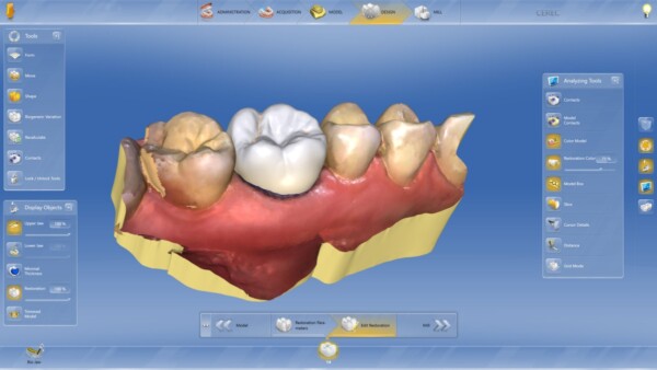 CEREC-Software-1-600×338