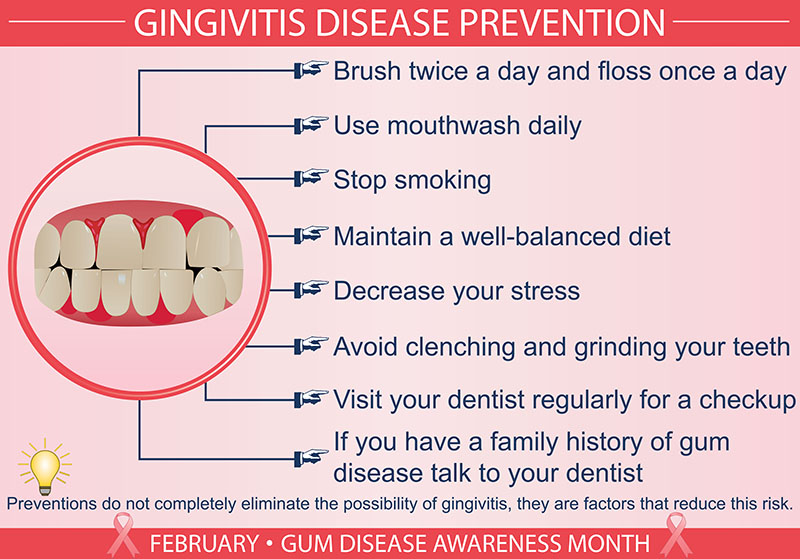 Gingivitis Disease Prevention Chart